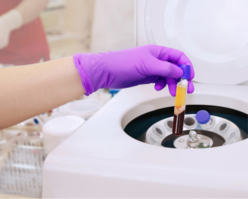 Gloved hand placing blood plasma tube into a laboratory centrifuge for processing.