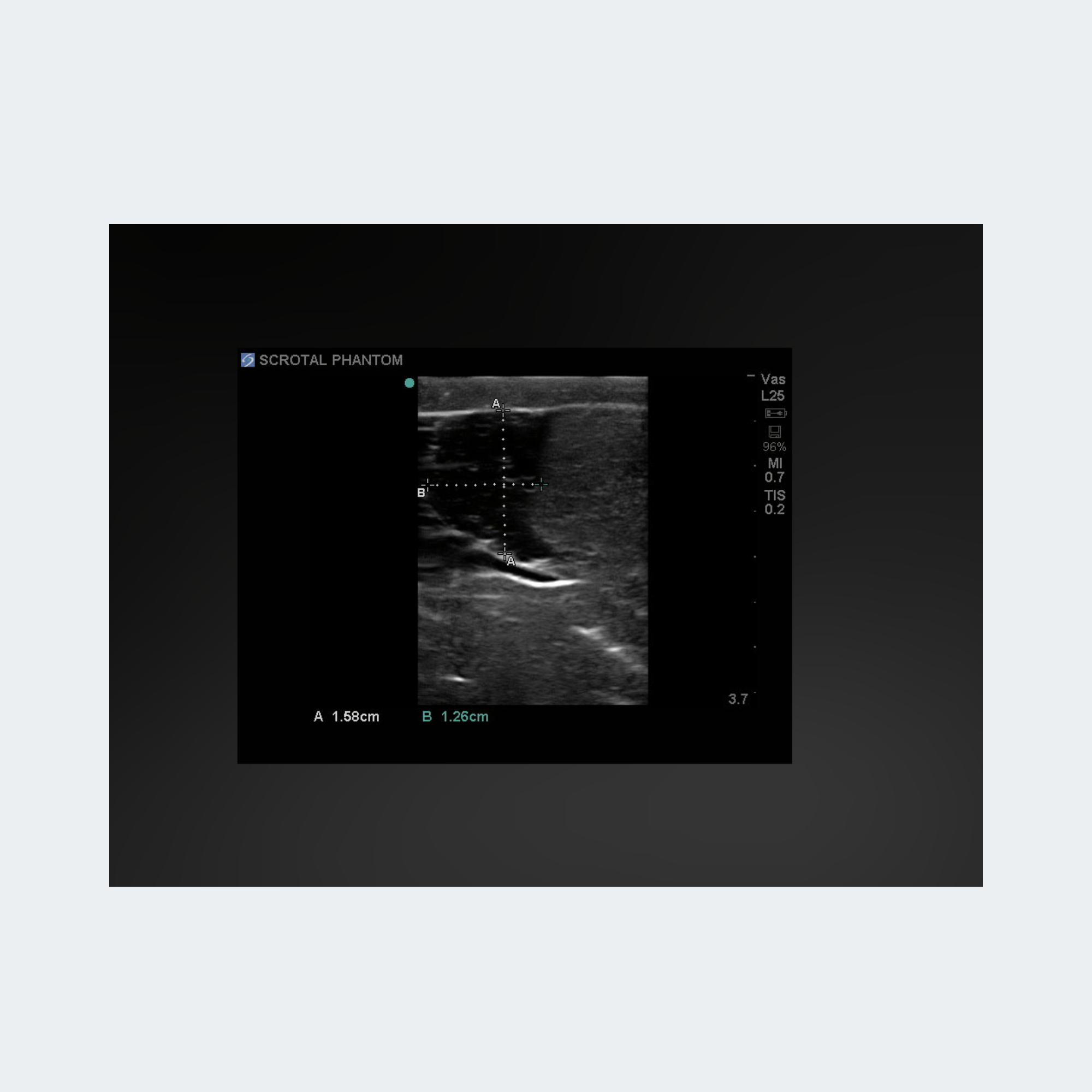 Blue Phantom Scrotal Ultrasound Training Model