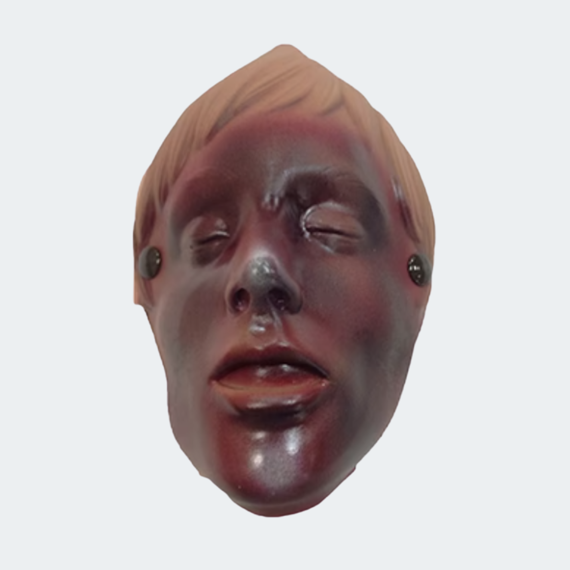 Burn Of The Face (Manikin Use Only)