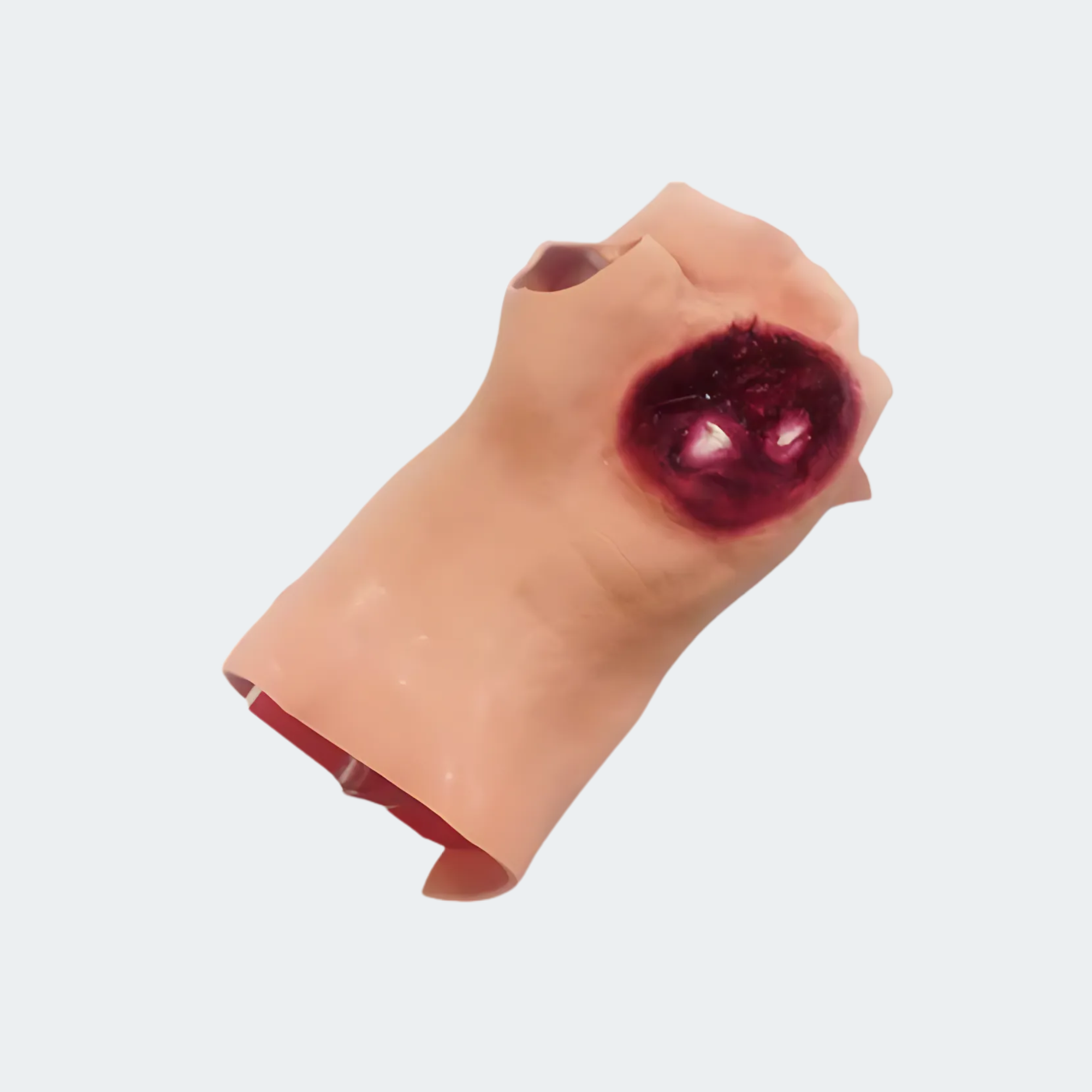Gunshot Wound Palm