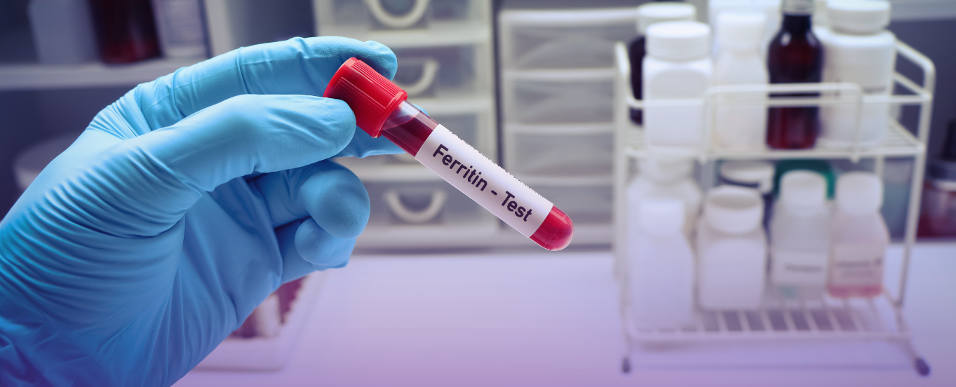 Gloved hand holding a red-capped blood sample tube labeled "Ferritin - Test" in a laboratory setting with medical bottles in the background.