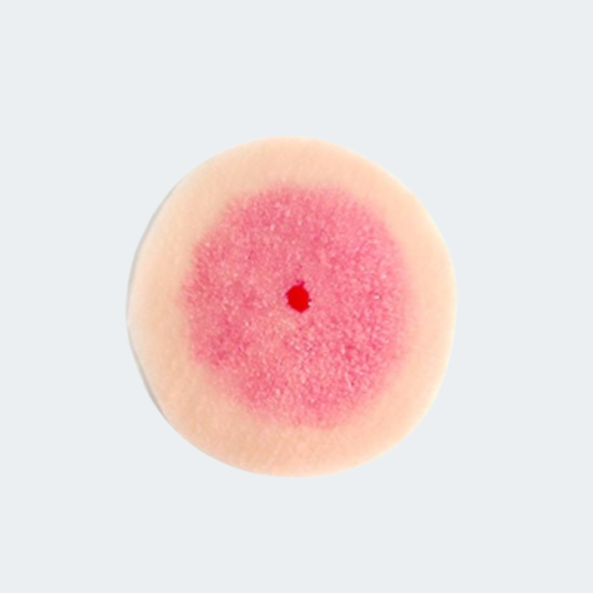 STAGE 1 ULCER