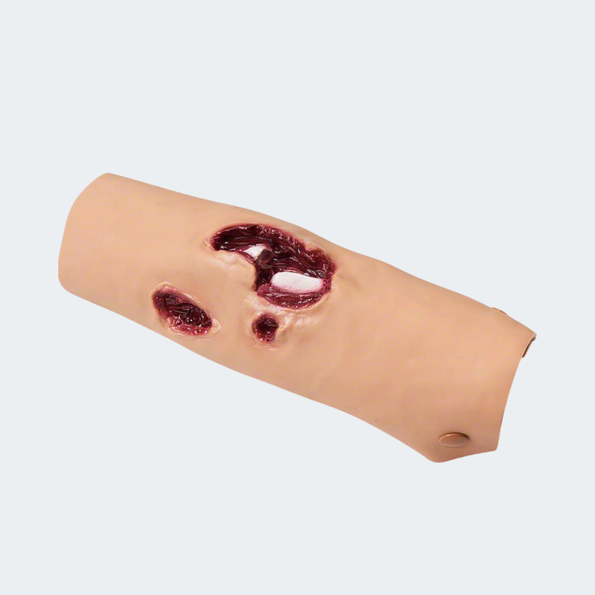 Simulaids Compound Fracture Tibia/Lower Leg