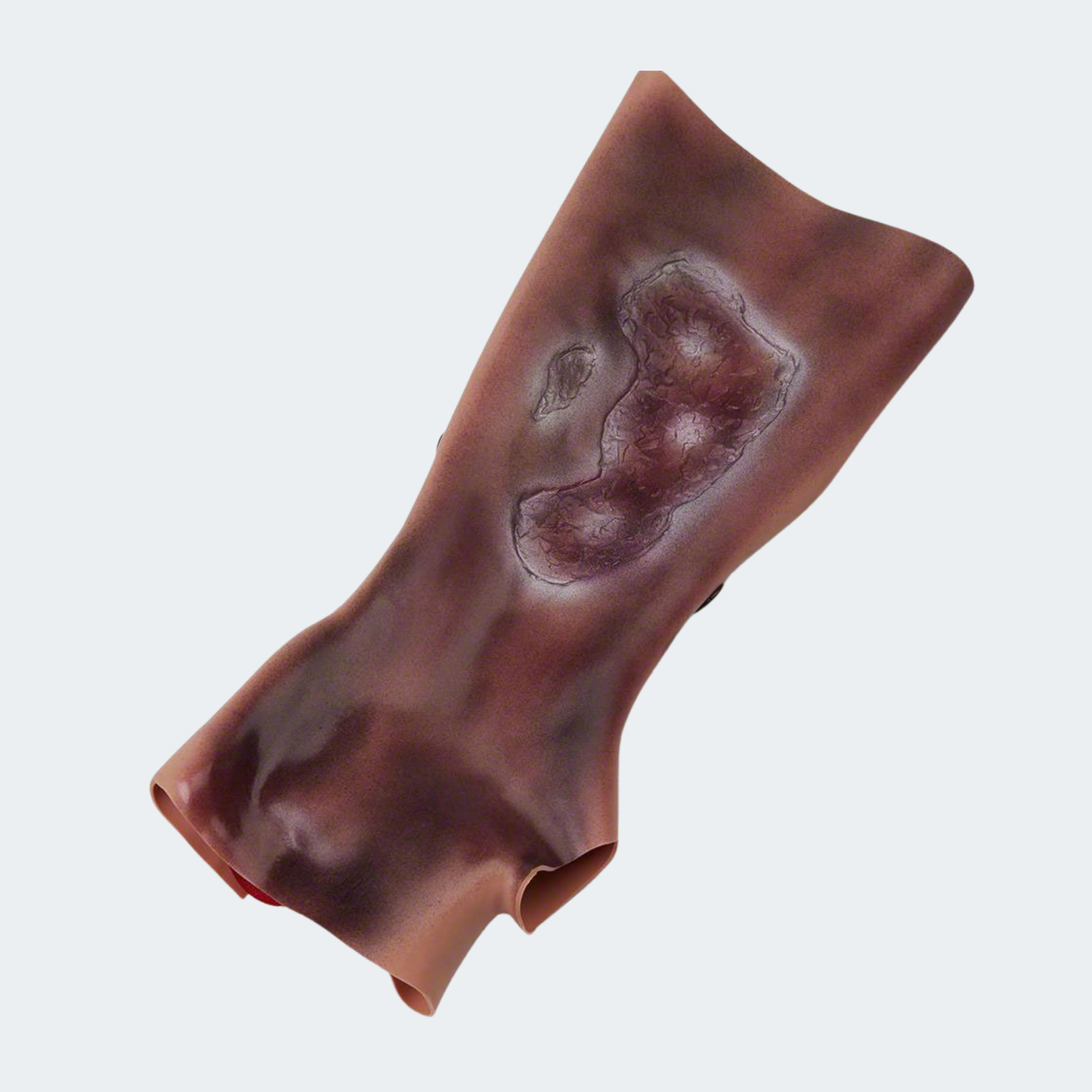 Simulaids Forearm with Simulated 2nd & 3rd Degree Burns