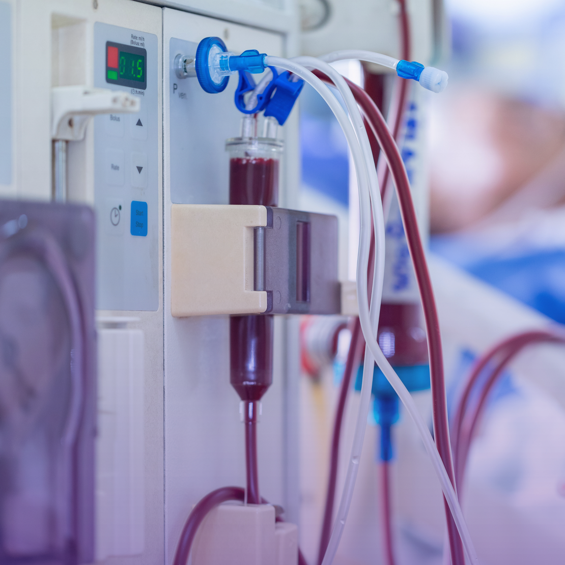 Close-up of a dialysis machine with tubes circulating blood, connected to the device.