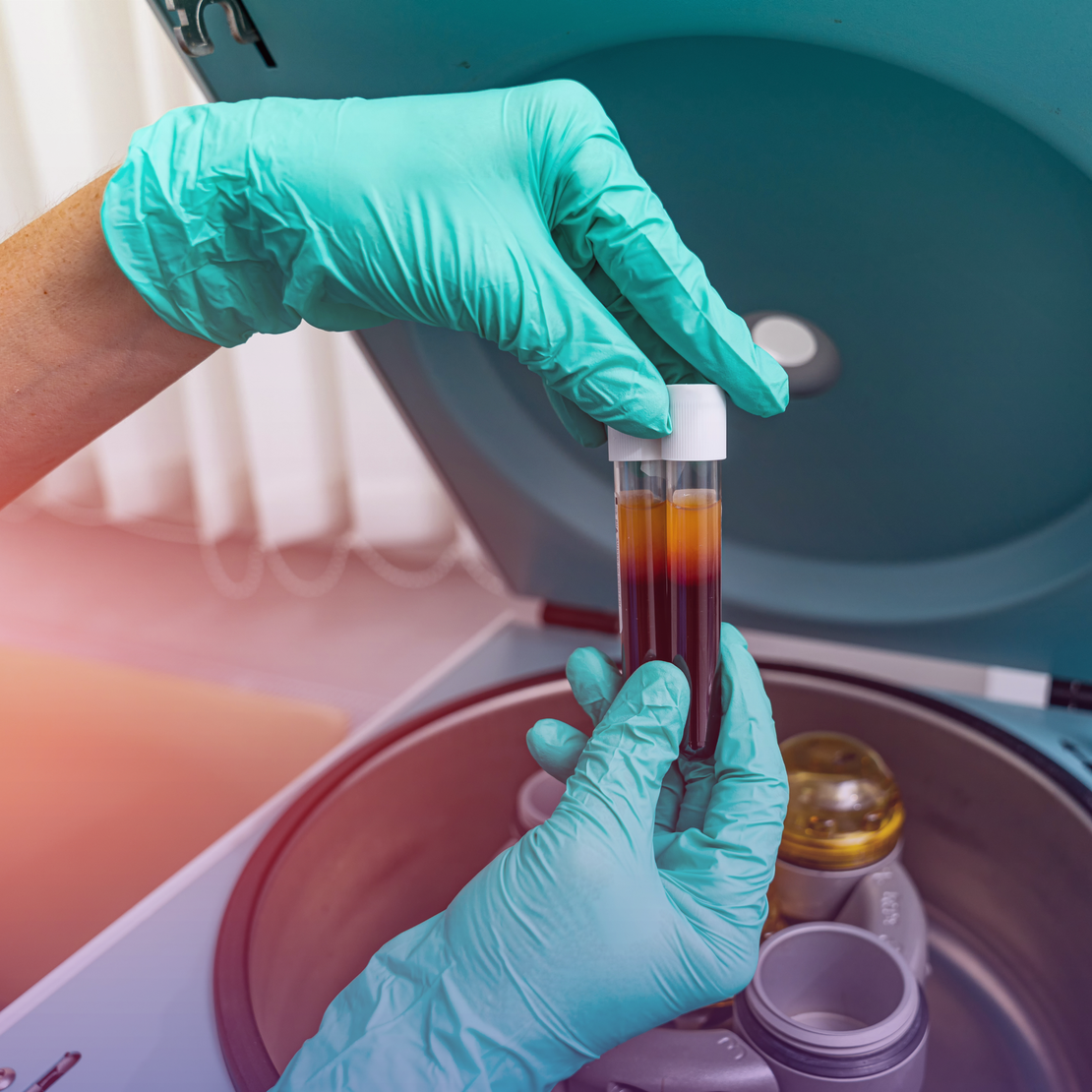 Gloved hands holding two blood sample tubes with separated plasma, positioned over a laboratory centrifuge.